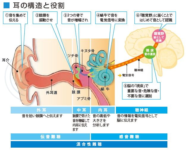 難聴にもいろいろな種類がある その一 感音性難聴 シグニア補聴器 Signia